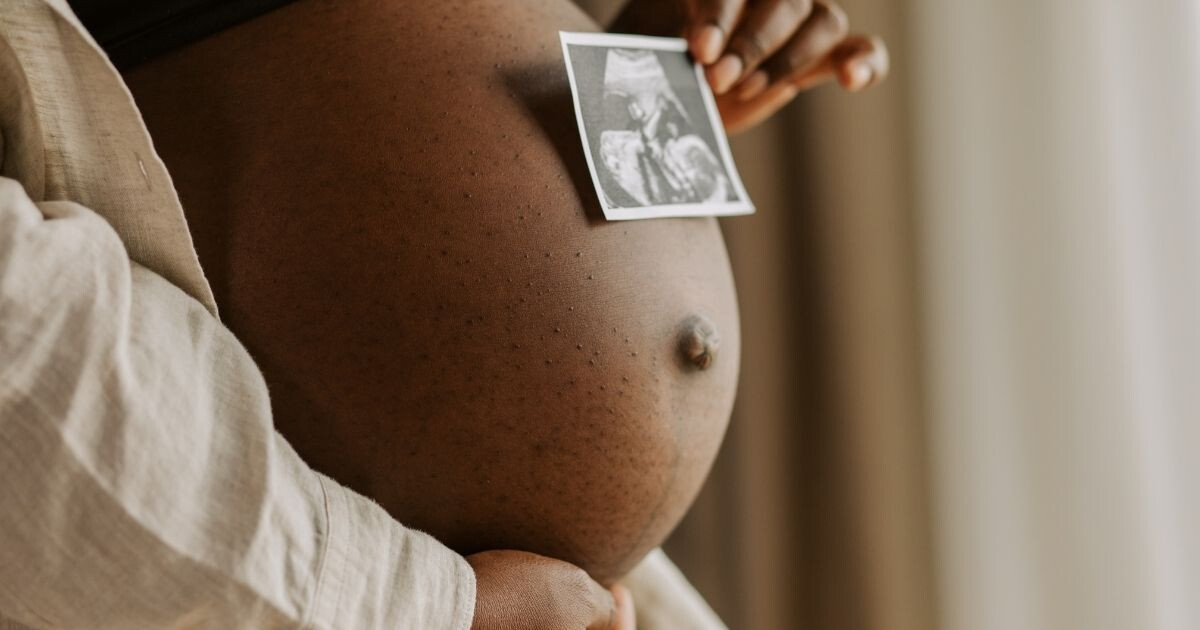 Article Naturopathie et grossesse : la méthode secrète des futures mamans les plus zen